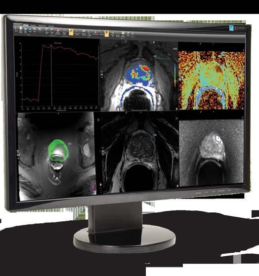 Bringing it all together UroNav interfaces directly with both DynaCAD Prostate and our clinical data management platform - connecting Radiology and Urology like never before.