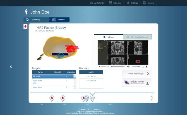 Following the biopsy procedure, biopsy core location data, images, and videos can be viewed in our intuitive, browser-based interface.