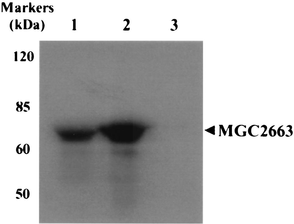 The arrowhead indicates the expressed His-tagged MGC2663. (B) His-tagged MGC2663 protein binds to RTA.