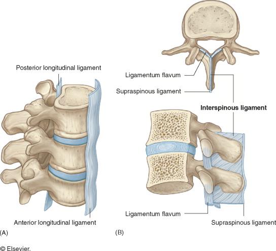 Interspinous Ligament Damage Interspinous ligaments lie between the spinous process of the vertebrae. These ligaments can be sprained or crushed by uncontrolled back movements.