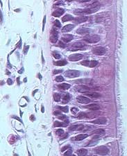 Muscle Tissue Formed by muscle cells for movement of and/or within the animal.