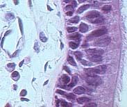Cell Shape: three types Pseudostratified Squamous epithelium is flattened cells. columnar Cuboidal epithelium is cube-shaped cells.