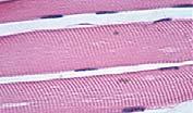 Types Muscle Fibers There are three types of muscle fibers.