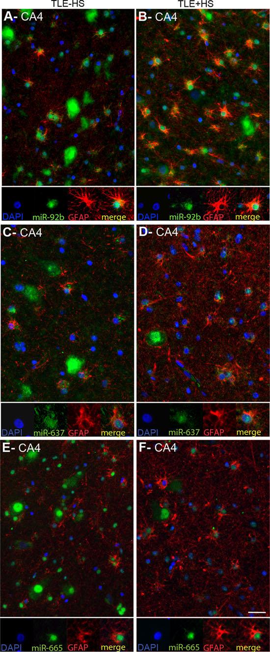 3136 A. A. Kan et al. Fig. 4 Expression of micrornas in GFAP-positive astrocytes in mtle.