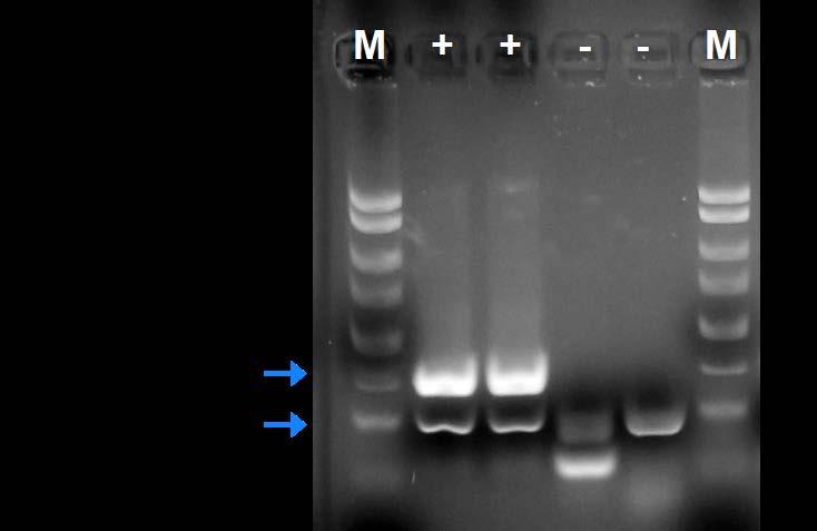 Figure 1: A representative 1X TAE, 1.4 % agarose gel showing the amplification of Cryptococcus neoformans at different concentrations.