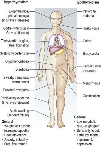Signs and Symptoms Hypothyroidism Hyperthyroidism Diabetes Mellitus The endocrine system Macleod's Clinical Examination.