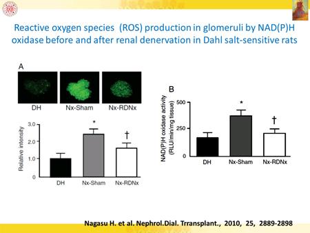 Slide 41 So there is some evidence that renal denervation can really be very protective against glomerulosclerosis, against