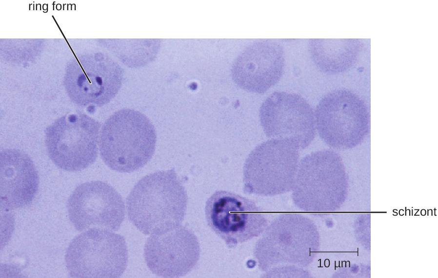 OpenStax-CNX module: m64867 4 Figure 2: A blood smear (human blood stage) shows an early trophozoite in a delicate ring form (upper left) and an early stage schizont form (center) of
