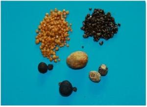 What are gallstones? However, we do get down a selected group of patients who we think that it's important to have some blood tests or examinations performed in a few weeks.