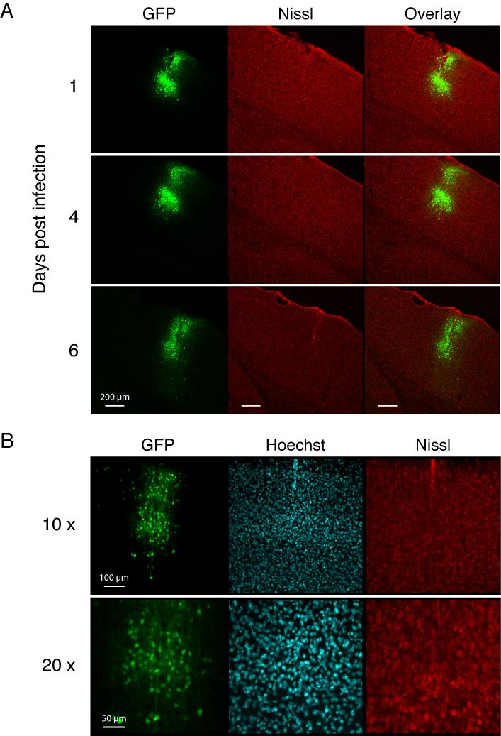 Chapter 2 Blockade of AMPAR endocytosis and LTD by G2CT 73 Figure 2.5 Infection with HSV produces robust and sustained expression in vivo A.