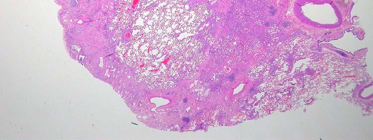 (often with overlying fatty metaplasia of the pleura) NSIP tends to show