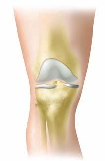 A third compartment is found behind the patella (kneecap), and all three compartments are covered with cartilage to help cushion and lubricate the bones during movement.