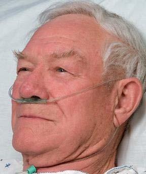 TO HELP YOU BREATHE This person is wearing a plas c tube in his nose called a nasal cannula. This helps a person to breathe be er while they sleep.