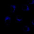 Fluorescence images of