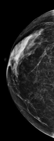 Clinical case: Breast