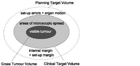 Planning Target Volum Is the final volume that must be irradiated to the tumoricidal dose to ensure that the CTV is actually irradiated to the desired dose.