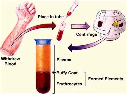 Composition of the Blood Plasma