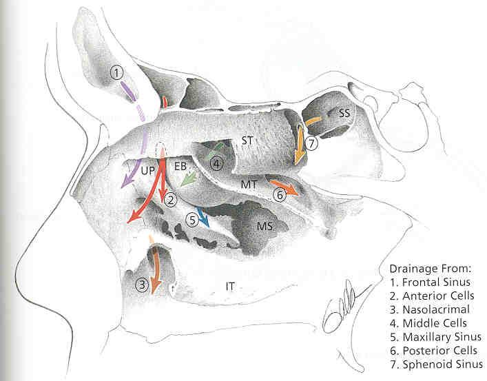 higher than that of the sphenoid sinus. Usually in the paramedian sagittal plane, the sphenoid sinus is the most superior and posterior air space. More laterally (1.