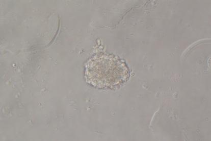 Technical Note _5 ver.1 2. Cell; Rat Hippocampus Neuronal Cell (DS pharma Biomedical Cat No. MB-X0402D ) 3. Human recombinant EGF 4. Human recombinant bfgf 1.