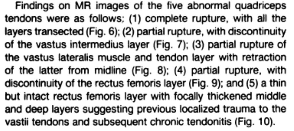 Quadriceps tendon Inconsistency regarding localization of tendon ruptures: Zeiss J, AJR 1992 * cited for: