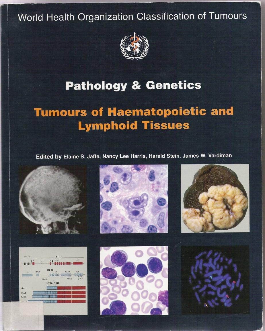 Evolution of lymphoma classification Rappaport Lukes and Collins (immunophenotype) Kiel Classification (Europe) Working