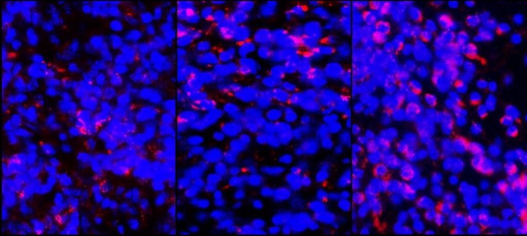 INCREASED LAG-3 STAINING AFTER COMBINATION TREATMENT LAG-3 DAPI MVA-BN-HER2 Tissue harvest: day 16 Anti-PD1