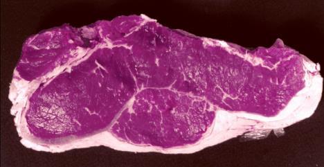 Causes: form of myoglobin in meat (the muscle protein