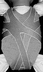 Attach them to the garment to optimize ageappropriate scapular stability and alignment (Fig. 13). Fig. 11 Strap bridge over scapula Fig. 12 Correct alignment while drawing strap down and across. Fig. 13 Secure lower strap ends to capture opposite scapula and assist with scapular depression 5.