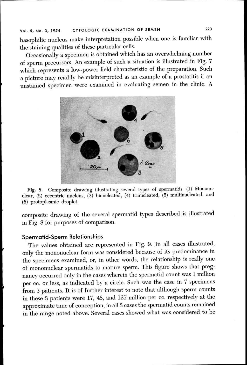 Vol. 5, No.3, 1954 CYTOLOGIC EXAMINATION OF SEMEN 223 basophilic nucleus make interpretation possible when one is familiar with the staining qualities of these particular cells.