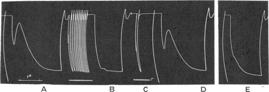 If contracting isotonically the whole of the notch, depression and recovery, usually occurs in a second or less, though occasionally recovery is slow (Fig. 5).