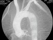 higher level of care Diaphragmatic Rupture Most commonly presents on the left side Often a delay in diagnosis if