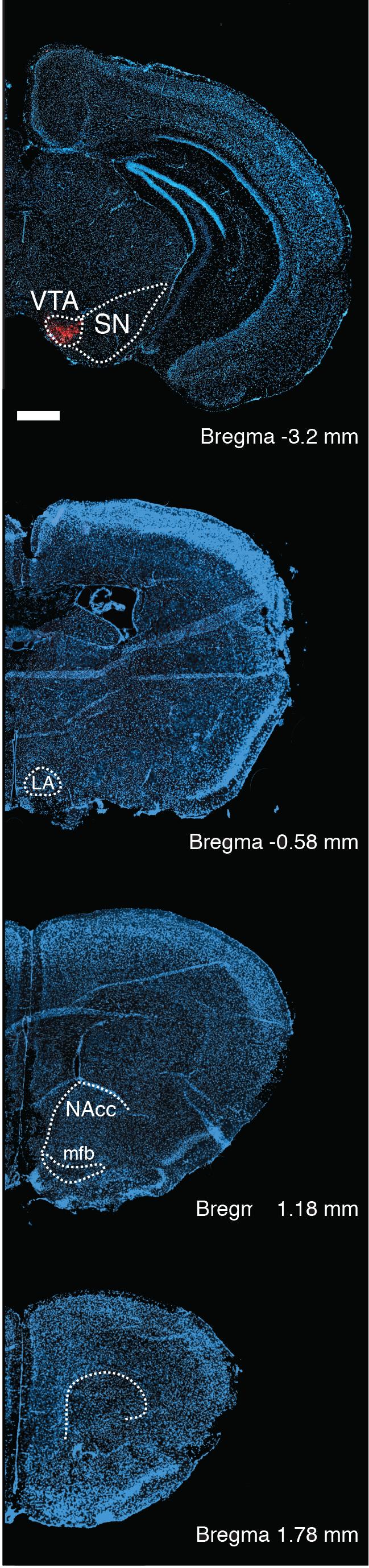 Bregma -0.58 mm Bregma -0.58 mm Bregma 1.1.mm Supplementary igure 1: DREADD expression in the VTA.