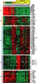 Melanoma CDH3, MMP10 Vertical Growth Phase Melanoma Microarray Analysis of Nevi Versus