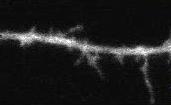 chemical gradients Axons form synapses at LGN, SC LGN axons grow to