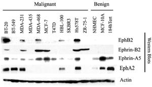 FIGURE 1. Western blot profiling of a panel of human breast cancer cell lines and noncancer cell lines, checked for the levels of expression of various ephrin ligands and receptors.