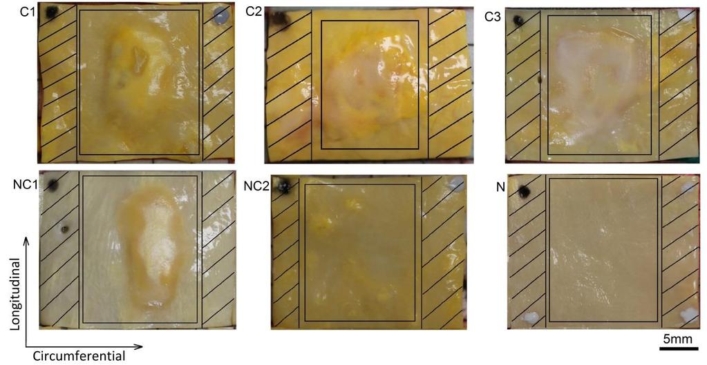 Figure 3-3. Photographic images of luminal surface in six specimens. C1, C2 and C3 had calcified plaques. NC1 and NC2 had noncalcified plaques.