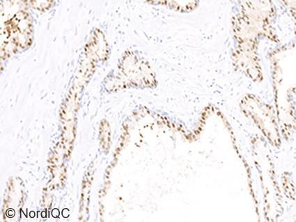Virtually all luminal epithelial cells lining the prostate glands must show a moderate to strong and distinct nuclear staining reaction.