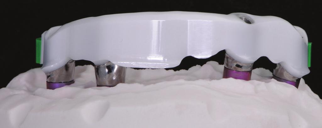 zirconia structure, in order to obtain a bar milled at 2.