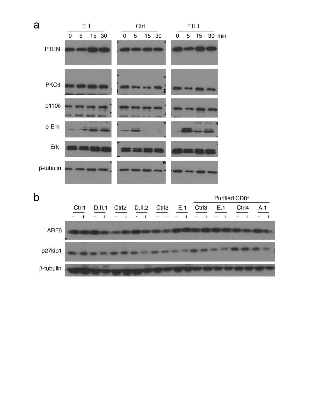 Supplementary Figure 7. Normal expression of signaling molecules in patient T cell blasts. (a) Immunoblots for PTEN, PKCθ, p110δ, p- Erk, total Erk, and β- tubulin in T cell lysates from patients E.
