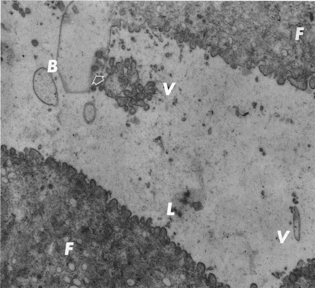 ELECTRON MICROSCOPIC STUDY OF THE APOCRINE DUCT 9 rrjj. _pai. 1, *0 V. FIG. 3. Secretion in the opocrine duct near the secretory segment. Pinchedoff microvilli (V) are seen in the lumen.