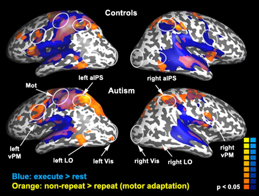 Figure 1. Cortical Responses during Movement Observation Experiment Green: Brain areas exhibiting significantly stronger responses during observation than rest.