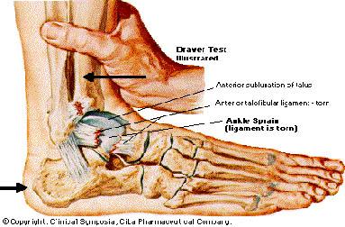 Physical Exam Tests for ankle stability Anterior drawer test if