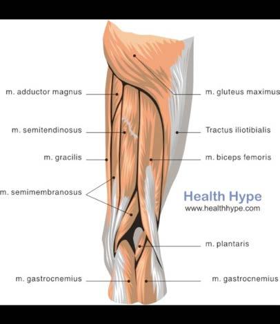 pain) Sartorius Muscle Function Hip Extensors Gluteus maximus Hamstrings Medial