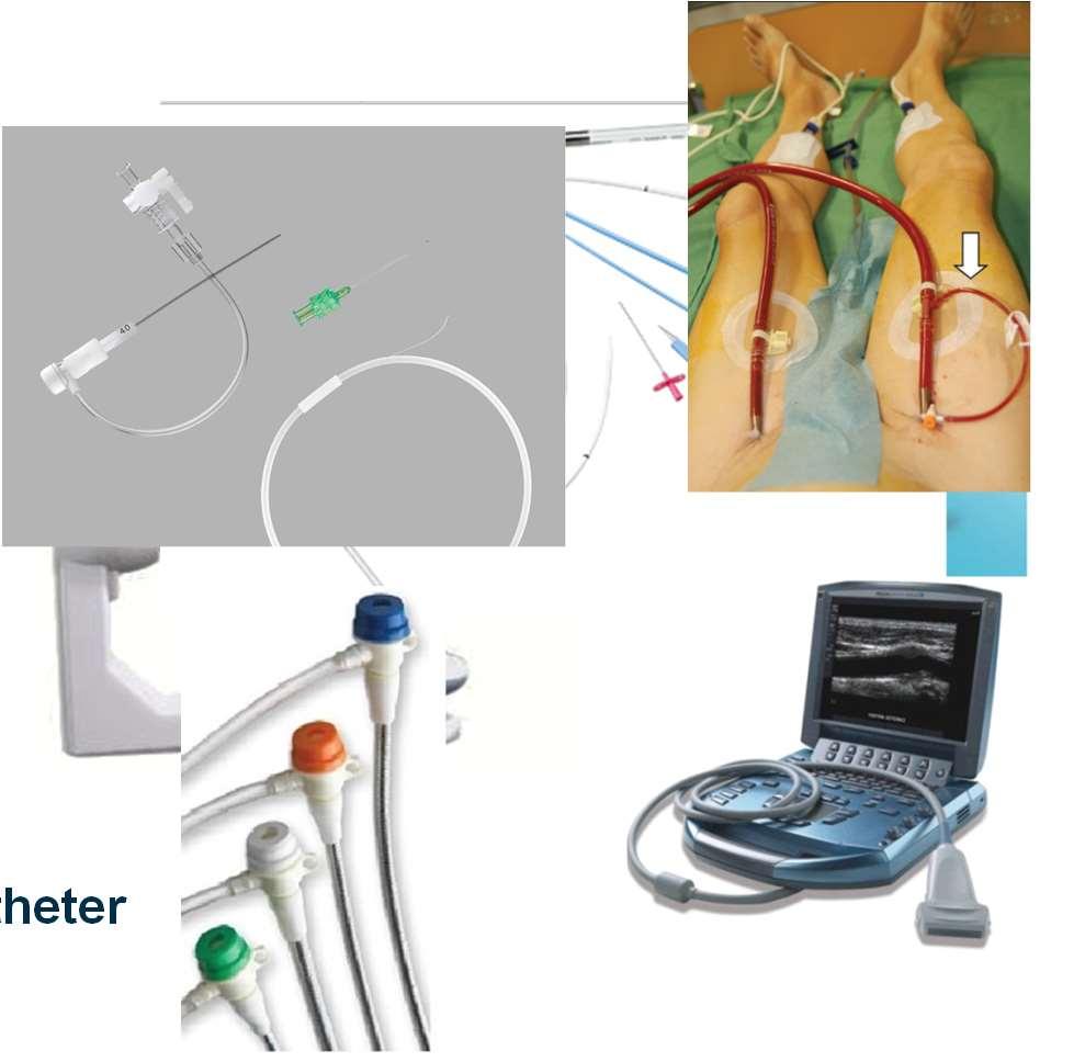 Percutaneous ECMO Cannulation Tool Box Fluoroscopy Multipurpose needle Guide wires Dilators Cannulas Stiff guide