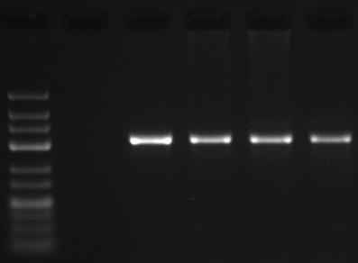 Cycle threshold (Ct) PCR based diagnostic approaches for PKDL Qualitative: ITS-1 PCR Quantitative:Real time PCR Visceral Leishmaniasis (VL); blood 1 2 3 4 5 6 1 2 3 4 700 bp 500 bp 400 bp 300 bp