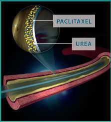 facilitates the transfer of PTX deep into vessel tissue Paclitaxel physicochemical properties Paclitaxel is approximately 200,000 times less water soluble
