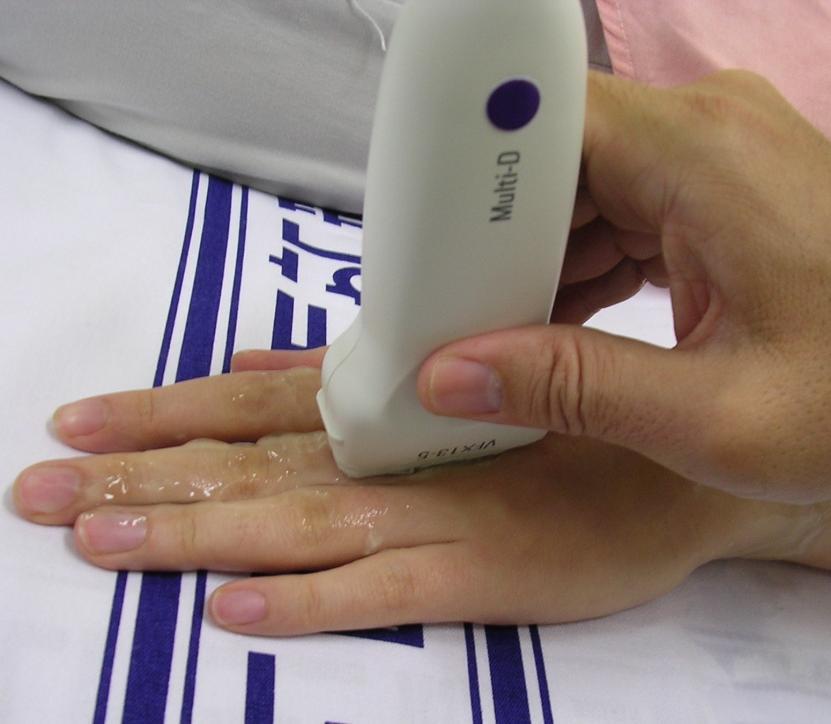 Dorsal Finger Evaluation ECU