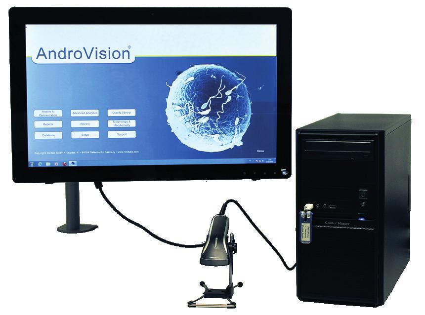 Microscopes AndroVision can be combined with a series of microscopes, preferably: Zeiss AxioLab and AxioScope Olympus