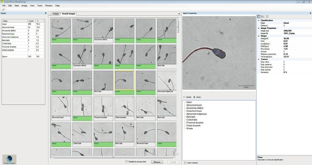 Software modules AutoMorph Module for the automated recognition of proximal and distal plasma droplets as well as bent tails of porcine and bovine semen.
