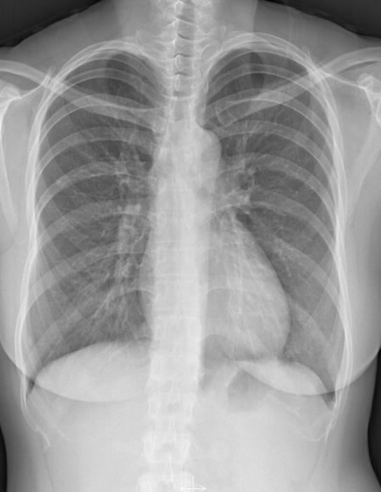 B A C Fig 11. A 41-year-old woman with dyspnea.